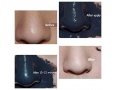 Маска-пленка для лица Missha Black Ghassoul Peel-Off Nose Pack